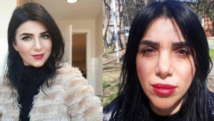 Estetik ameliyatı oldu, psikolojisi bozuldu